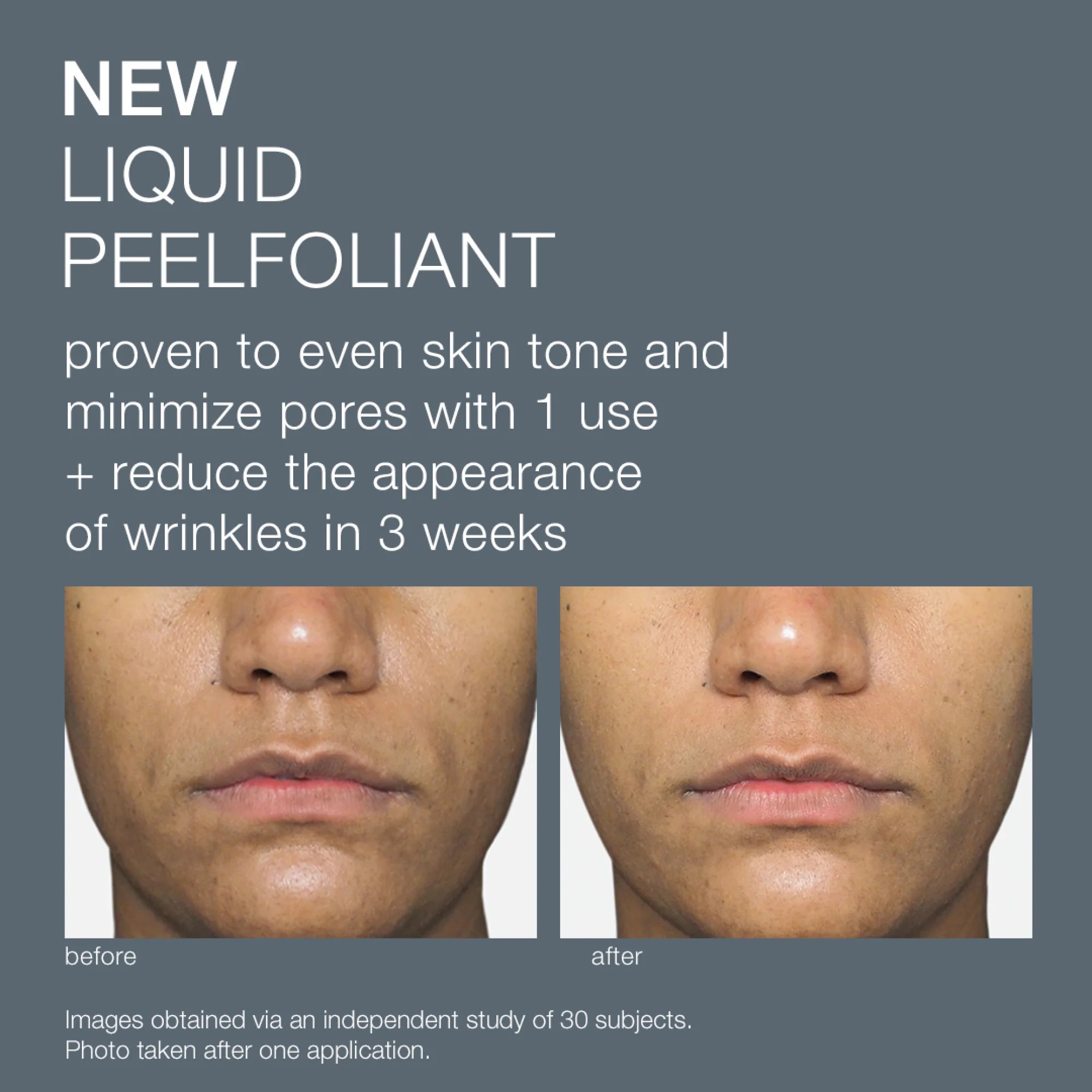 Dermalogica-Liquid Peelfoliant 59ml