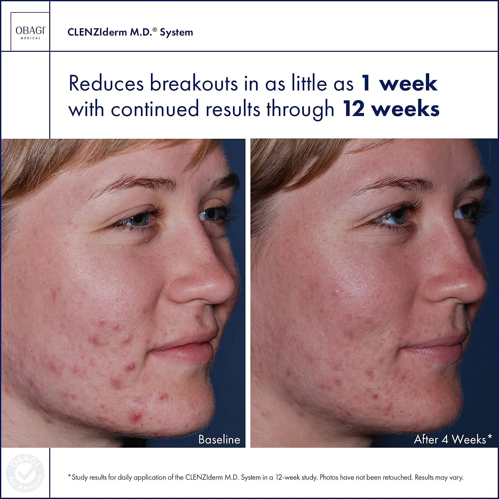Obagi | CLENZIderm M.D. Acne Therapeutic System