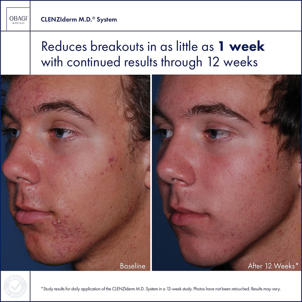 Obagi | CLENZIderm M.D. Acne Therapeutic System